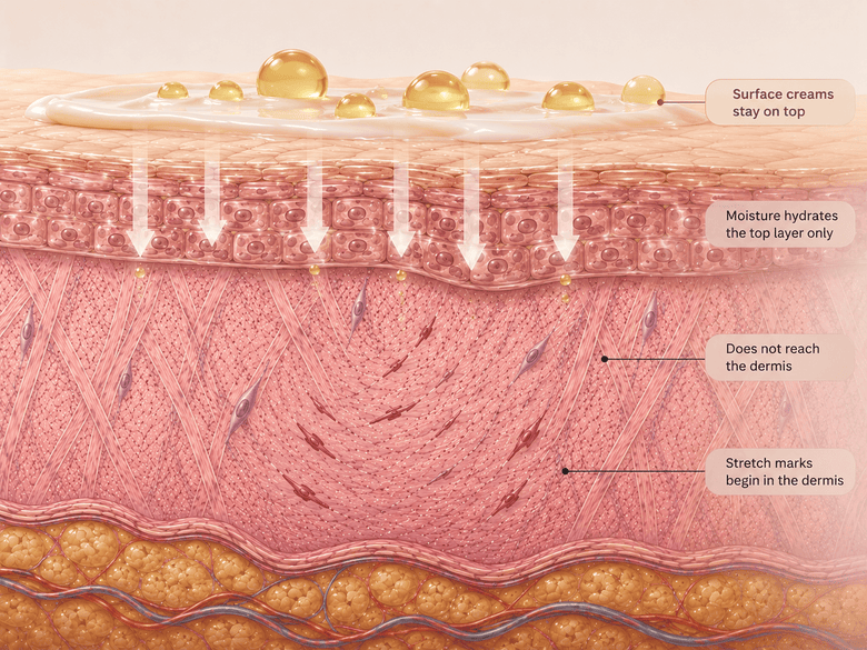3: Surface Creams Fall Short