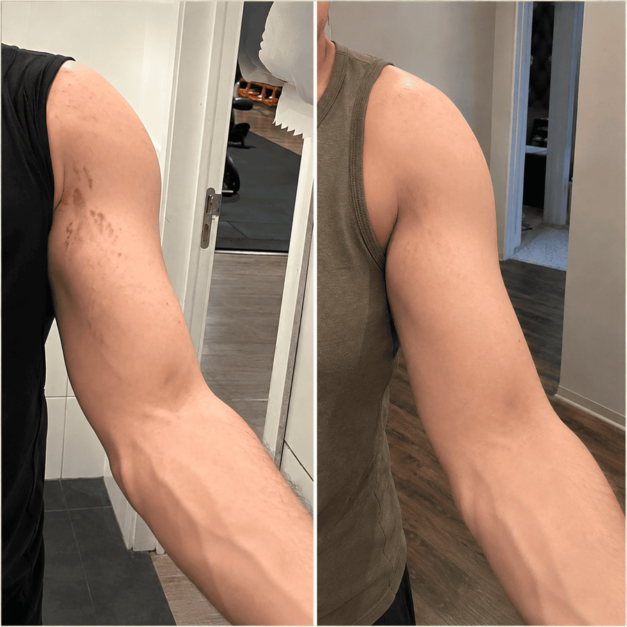 Arms