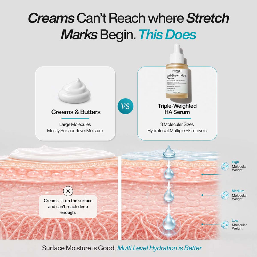 Anti-Stretch Marks Serum