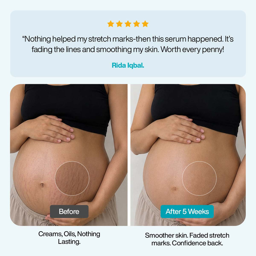 Anti-Stretch Marks Serum