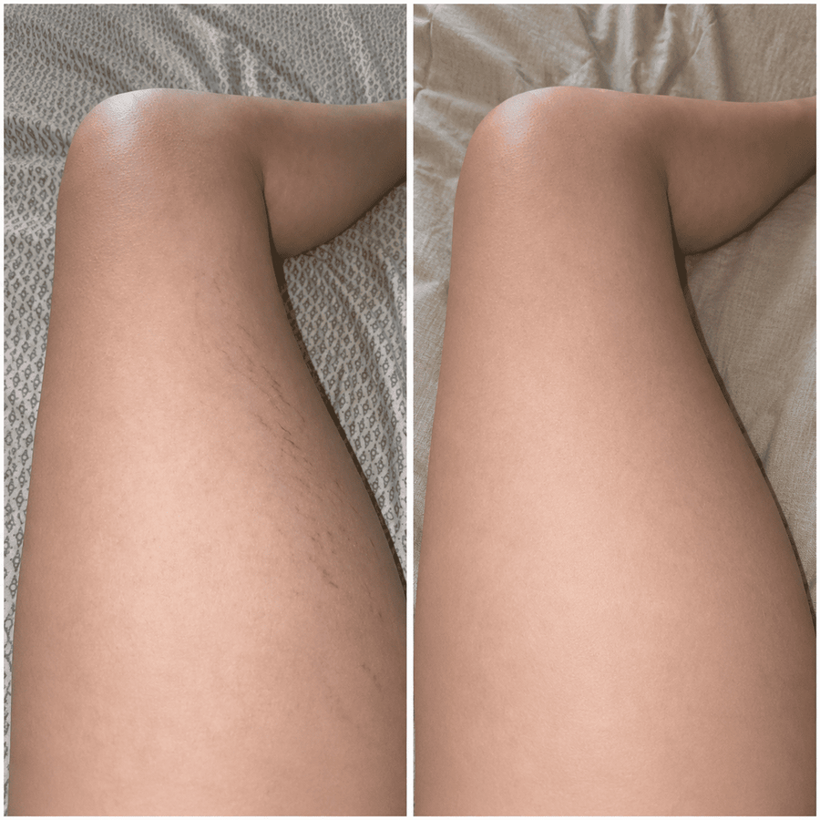 Thighs