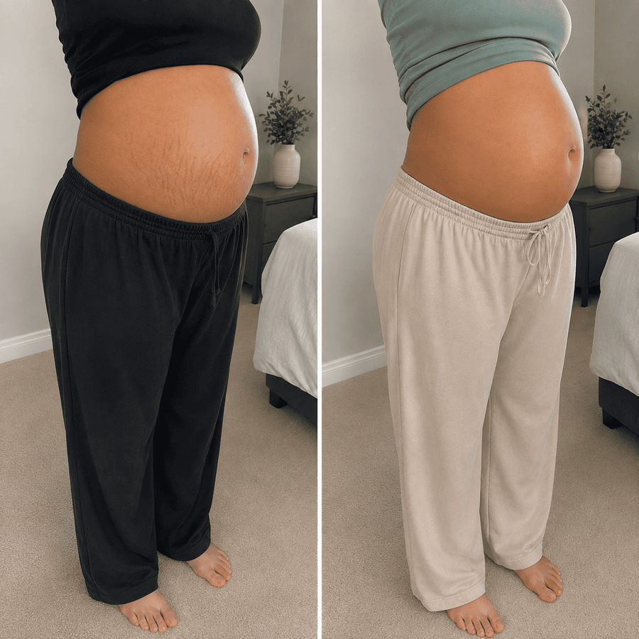 Pregnancy Stretch Marks